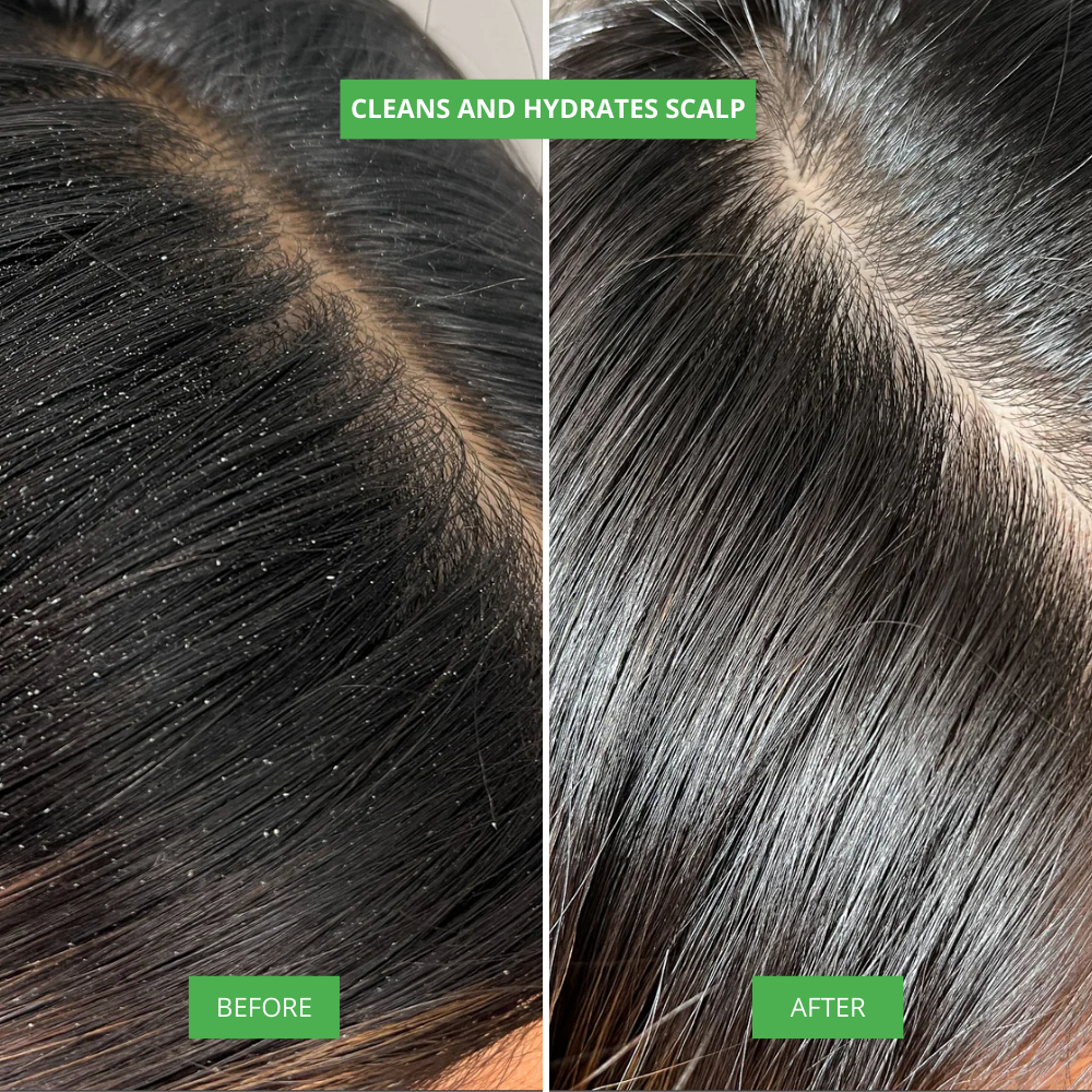 NIWOMAN – Rosemary Amino Acid Shampoo™