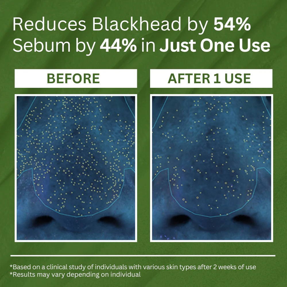 NIWOMAN™ - Holy Basil Bubble Deep Mask