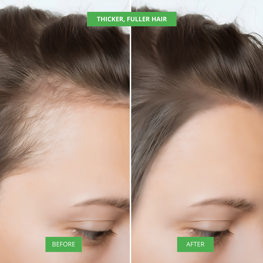 NIWOMAN – Rosemary Amino Acid Shampoo™