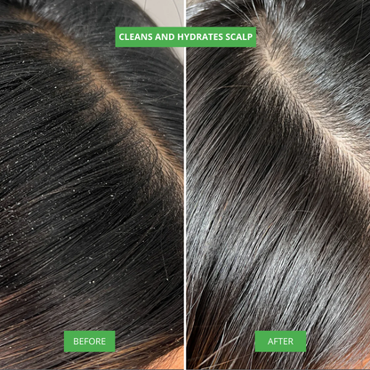 NIWOMAN – Rosemary Amino Acid Shampoo™