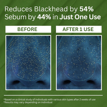 NIWOMAN™ - Holy Basil Bubble Deep Mask